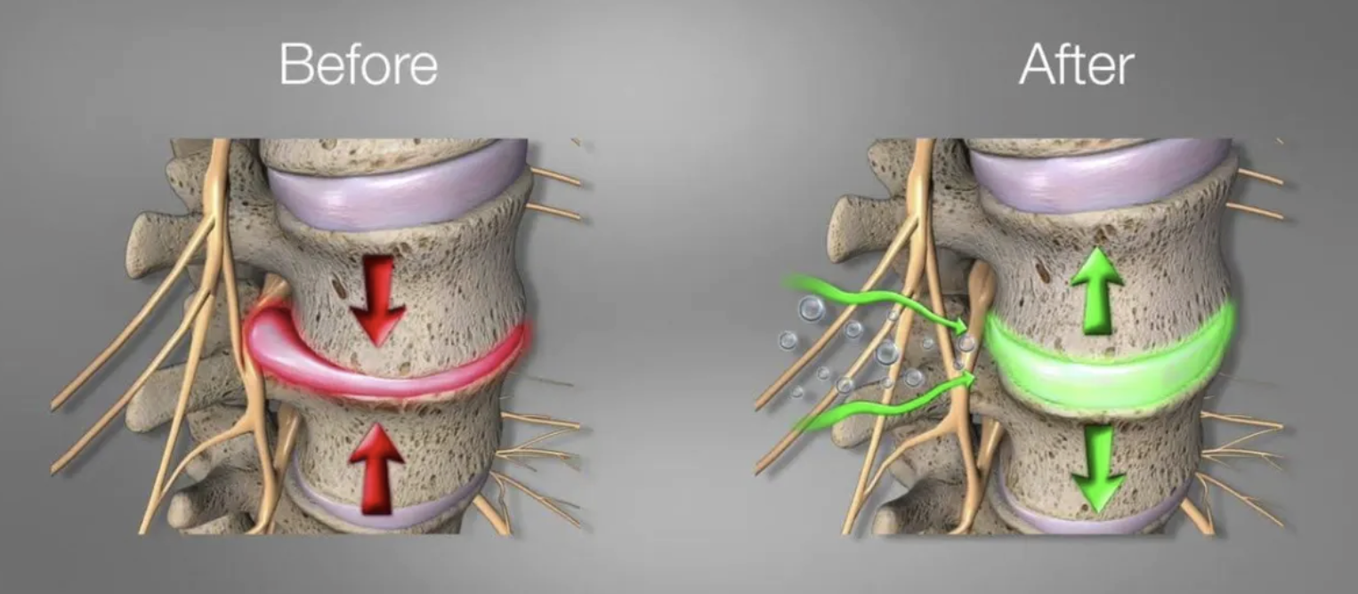 AZ Spine Centers | Phoenix Chiropractor & Auto Accident Recovery
